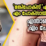 മങ്കിപോക്സ് എങ്ങനെ എം പോക്‌സായി? എന്താണ് എം പോക്സ്, അറിയാം ലക്ഷണങ്ങളും പ്രതിരോധ മാർഗങ്ങളും